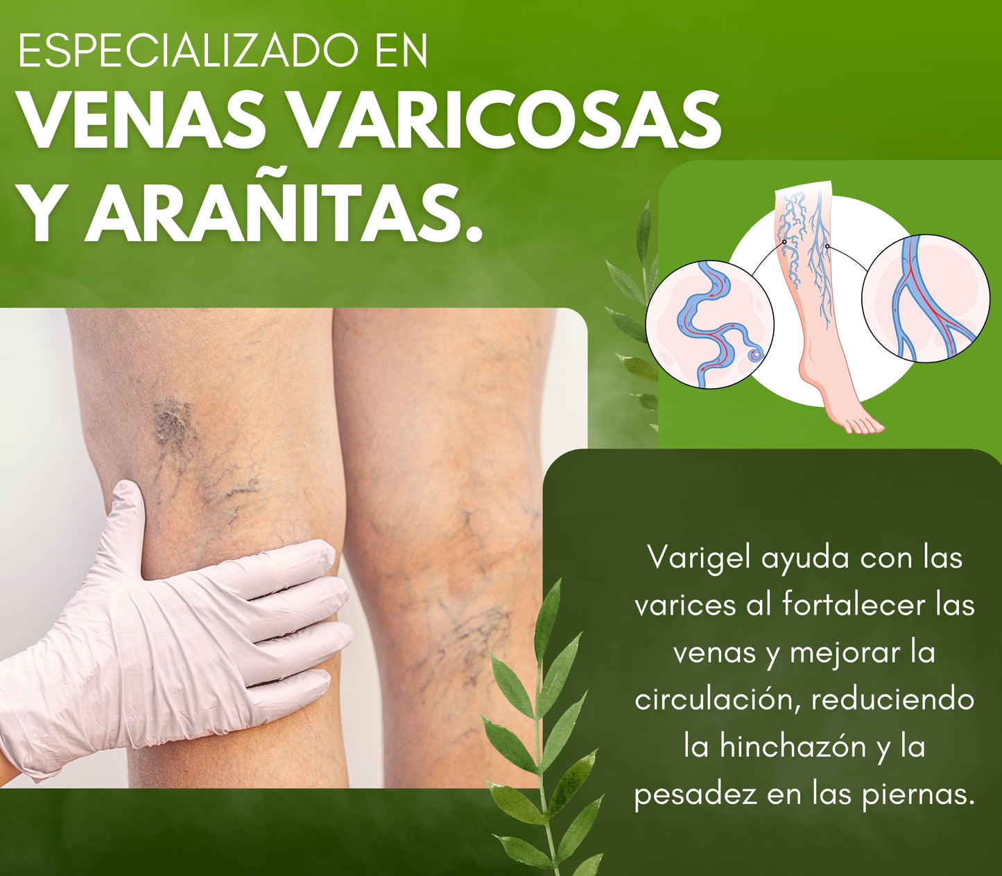 Varigel 225gr. | Alivio para Varices, Hinchazón y Piernas Cansadas con Efecto Refrescante Inmediato