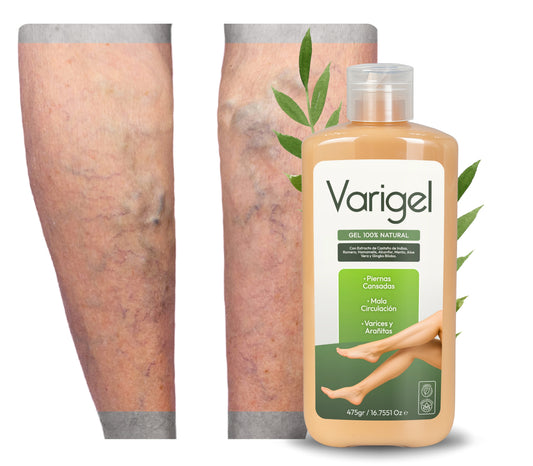 Varigel 475gr. | Alivio para Varices, Hinchazón y Piernas Cansadas con Efecto Refrescante Inmediato