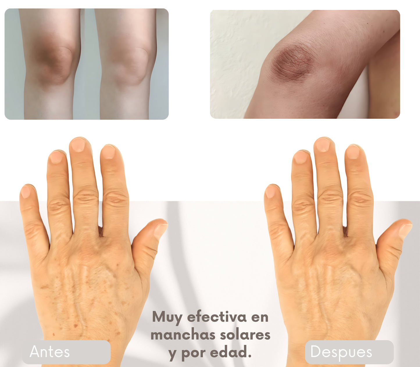 Clear Tone 50g. | Crema Despigmentante para Axilas, Rodillas, Codos, Cuello, Rostro y Manos – Ayuda a Aclarar Manchas por Sol, Edad y Desequilibrios Hormonales