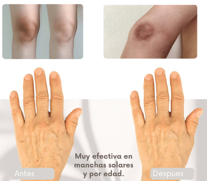 Clear Tone 50g. | Crema Despigmentante para Axilas, Rodillas, Codos, Cuello, Rostro y Manos – Ayuda a Aclarar Manchas por Sol, Edad y Desequilibrios Hormonales
