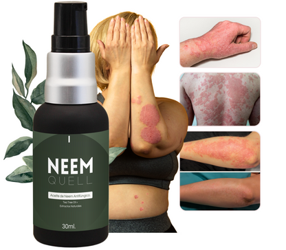 Neem Quell | Aceite de Neem Concentrado para el Cuidado de la Piel, Cuero Cabelludo y Uñas