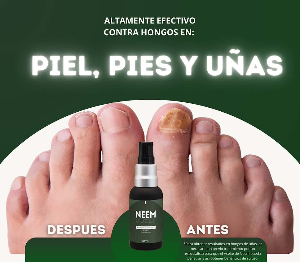 Neem Quell | Aceite de Neem Concentrado para el Cuidado de la Piel, Cuero Cabelludo y Uñas