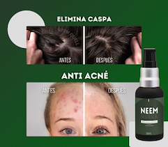 Neem Quell | Aceite de Neem Concentrado para el Cuidado de la Piel, Cuero Cabelludo y Uñas